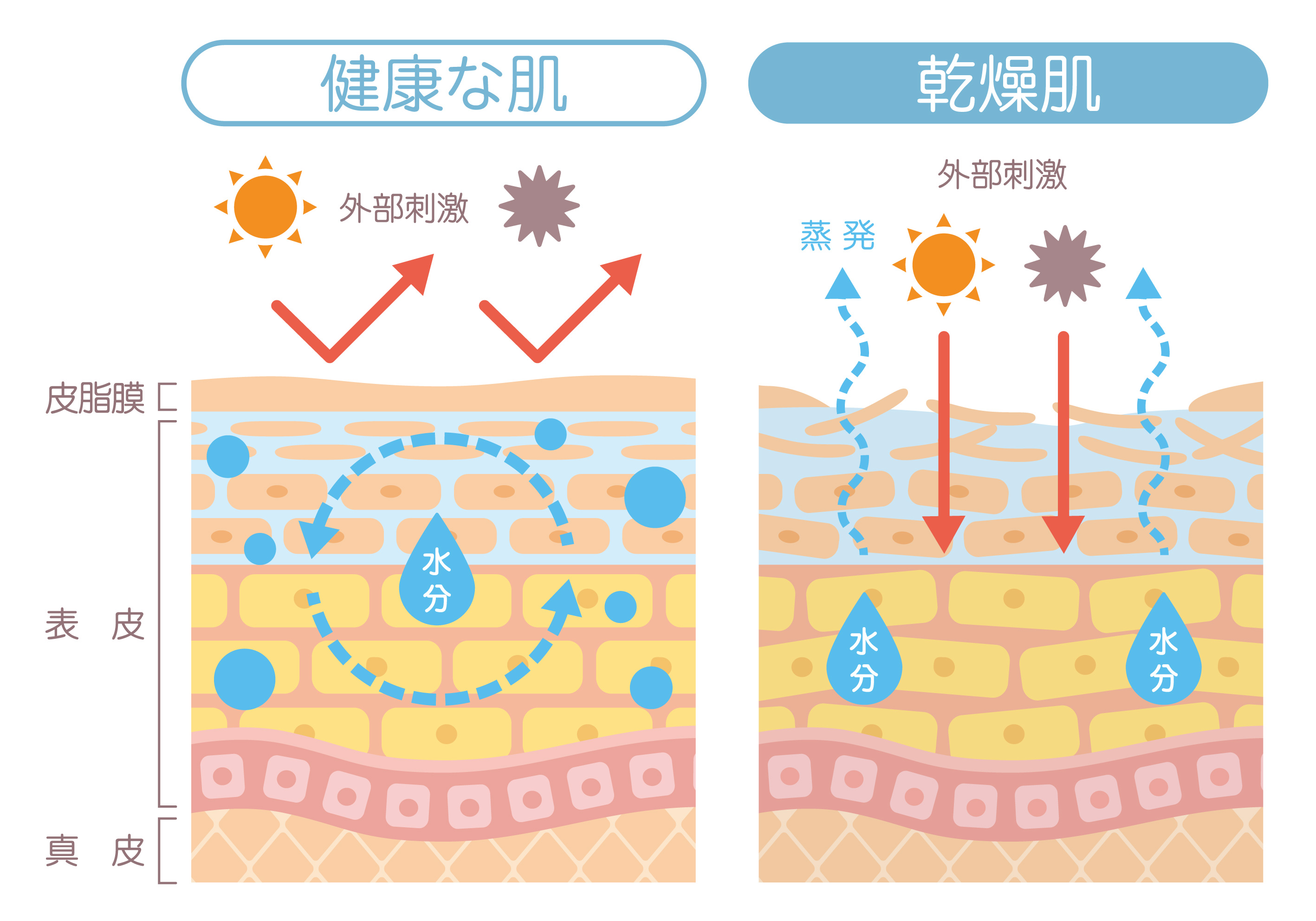 外部刺激による健康な肌と乾燥肌のイメージ