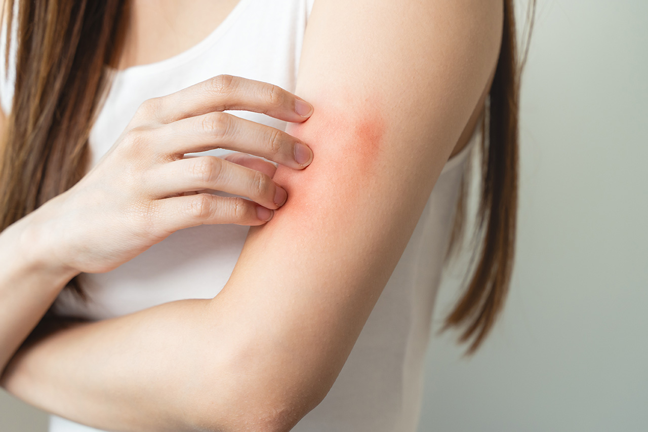 ゆらぎ肌とは？原因とバリア機能を立て直す方法を解説