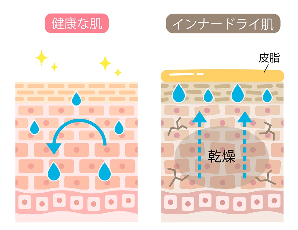 インナードライ肌のイメージ