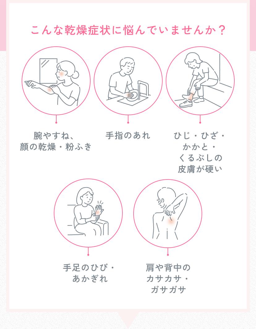 こんな乾燥症状に悩んでいませんか？